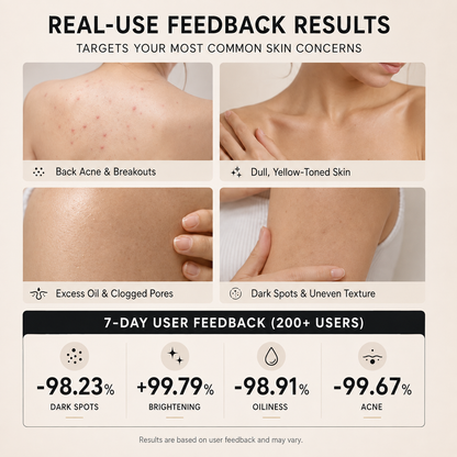 ⚡ Niacinamide Skin Soap – Brightens, Fades Spots & Freckles